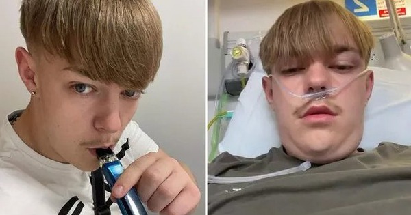 Thanh niên hút thuốc lá điện tử liên tục từ khi 12 tuổi, sau 5 năm kết quả khám bệnh gây sốc avatar1738767056570 1738767056953240426747 3 0 325 615 crop 17387670930491624048415jpg