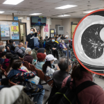 Một nhà 5 người đồng loạt mắc cúm sau chuyến đi chơi, có người biến chứng nặng, trắng phổi vì bỏ lỡ "48 giờ vàng" avatar1738903118224 17389031186761973505857 0 0 503 960 crop 1738903128789240119905png