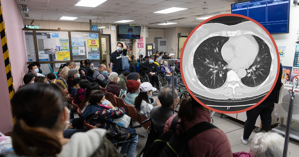 Một nhà 5 người đồng loạt mắc cúm sau chuyến đi chơi, có người biến chứng nặng, trắng phổi vì bỏ lỡ "48 giờ vàng" avatar1738903118224 17389031186761973505857 0 0 503 960 crop 1738903128789240119905png