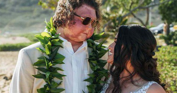 Người đàn ông được phẫu thuật ghép mặt đầu tiên trên thế giới kết hôn, nhan sắc cô dâu và chuyện tình cổ tích gây sốt avatar1739430617015 173943061728628343161 0 35 315 539 crop 17394306271141094846373jpg