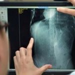 Kim 15mm sót trong gan bệnh nhân nhưng không thể lấy ra, bệnh viện khẳng định: "Đâu phải lỗi của chúng tôi" avatar1740045742977 17400457436591857870400jpg