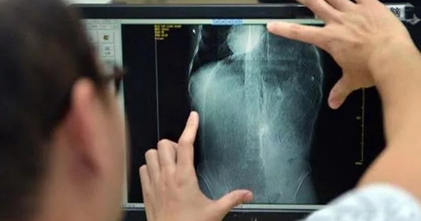 Kim 15mm sót trong gan bệnh nhân nhưng không thể lấy ra, bệnh viện khẳng định: "Đâu phải lỗi của chúng tôi" avatar1740045742977 17400457436591857870400jpg