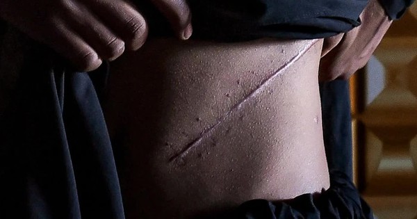 Bóc trần đường dây mua bán thận chấn động ở Myanmar: Từ những con nợ đến bàn mổ ở Ấn Độ avatar1740626504491 17406265047941924490312 0 30 878 1435 crop 17406265218441249630290jpg