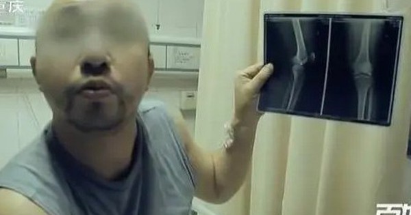 Nửa đêm đau nhói ở gối, người đàn ông phải nhập viện liền được bác sĩ yêu cầu: Gọi cảnh sát ngay lập tức! avatar1740716915557 17407169158381670148328 0 76 291 542 crop 1740716930994778514863jpg