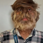 Người đàn ông lập kỷ lục có khuôn mặt nhiều lông nhất avatar1741683233890 1741683234072531239295png