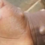 Châu Phi: Dịch viêm màng não cùng nhiều bệnh chết người diễn biến phức tạp avatar1741782480173 17417824807542136316125 0 1 415 665 crop 17417824988571677323263jpg