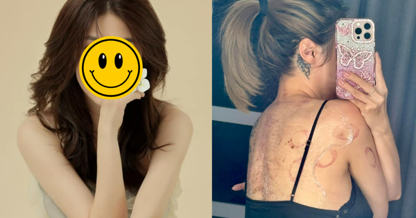 Sao nữ Vbiz đang điều trị trầm cảm: Cập nhật tình hình sức khỏe đáng chú ý avatar1741838631215 1741838631713810353387 0 0 586 1119 crop 1741838711738785079179png