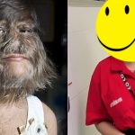 Cô gái nhiều lông nhất thế giới gây ngỡ ngàng khi cạo sạch lông mặt, cuộc sống hiện tại bên bạn trai càng gây bất ngờ avatar1741961046562 1741961047341576625392jpg