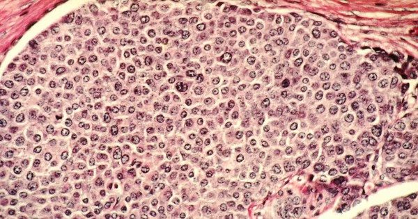 Xác định được hợp chất thực vật tự nhiên có thể ngăn chặn ung thư avatar1742013586356 17420135868311230438068jpg