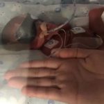 Hy hữu hai trẻ sinh đôi ra đời cách nhau 3 ngày avatar1742032966230 17420329664481016606333jpeg