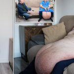 Ác mộng giảm cân: Người đàn ông với khối da thừa khổng lồ khiến các bác sĩ cũng sốc avatar1742717198892 1742717199327998464295 0 12 382 623 crop 1742717225309523092268jpeg