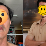 Sao nam Vbiz phát hoảng vì mặt biến dạng, sưng phồng bất thường avatar1743399040257 1743399050491231932068png