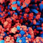 Nga lên tiếng về loại virus chưa xác định gây ra tình trạng sốt và ho ra máu avatar1743556367360 17435563677741958399626jpg