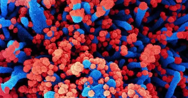 Nga lên tiếng về loại virus chưa xác định gây ra tình trạng sốt và ho ra máu avatar1743556367360 17435563677741958399626jpg