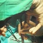 Bé trai 3 tuổi nôn ra giun, đến khi phẫu thuật bác sĩ càng bất ngờ avatar1744633041853 174463304252641059352 0 29 315 533 crop 1744633056724202908034jpg