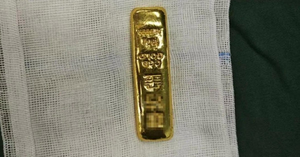 Tò mò, cậu bé 11 tuổi nuốt thỏi vàng vào bụng avatar1744689394100 1744689394697476238473jpg