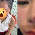 Thêm sao nữ Vbiz gặp tai nạn trên sân pickleball, vết thương chảy máu giữa mặt avatar1745072644536 1745072645189598734970 0 0 578 1104 crop 1745072686911917483432png