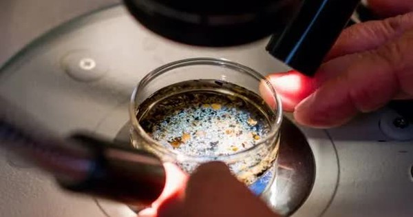 Lần đầu tiên phát hiện vi nhựa trong dịch nang buồng trứng của con người avatar1745144587323 1745144589862551093629jpg