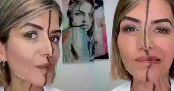 Nữ bác sĩ tiêm botox nửa khuôn mặt để chứng minh tác hại của cách làm đẹp này avatar1745742592022 174574259219654238353 0 62 274 500 crop 17457426244071579081954jpg