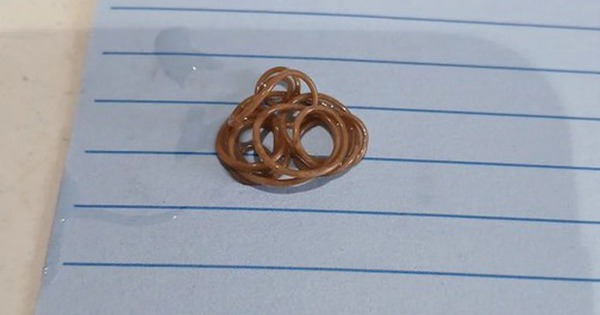 Phát hiện kinh dị của người phụ nữ trong phòng tắm avatar1745827134420 17458271347391932843690 0 12 315 516 crop 1745827148533390500625jpg