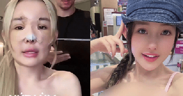 Ngân 98 "nghiện" phẫu thuật thẩm mỹ, chuẩn bị "đập mặt xây lại" lần thứ 12 avatar1746859214627 17468592157411376601317 0 63 261 561 crop 1746859269600238452690png