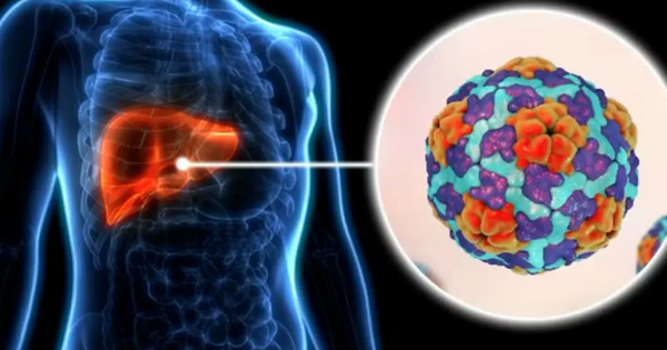 Số ca tăng vọt, Los Angeles (Mỹ) tuyên bố bùng phát dịch viêm gan A avatar1747018589882 17470185902591846086577png