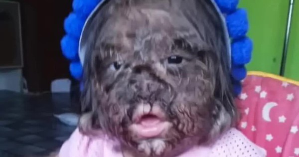 Vì sao bé gái "người sói" đầy lông lá này được gọi là "đứa trẻ đến từ thiên đường"? avatar1747300095851 1747300096082984689822 154 0 877 1157 crop 1747300120847455874572jpg