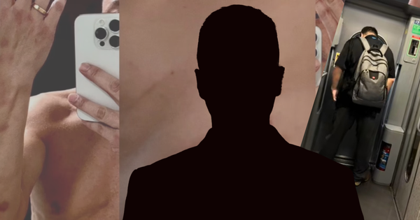 Vụ việc cực sốc: Nam diễn viên công khai hình ảnh bị chuốc thuốc và xâm hại tình dục tới mức suy thận avatar1747375327186 174737532827183257994 0 0 824 1575 crop 1747375526106696934710png