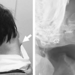 Những hình ảnh đáng sợ của việc chơi game không khoa học, cảnh báo cho game thủ avatar1747647312893 1747647313455798928765png