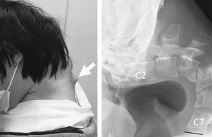 Những hình ảnh đáng sợ của việc chơi game không khoa học, cảnh báo cho game thủ avatar1747647312893 1747647313455798928765png