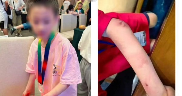 Vụ việc gây rúng động: Thần đồng cờ vây 9 tuổi nghi nhảy lầu tự tử, cộng đồng mạng bàng hoàng avatar1747906176901 1747906177471673269321png