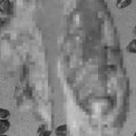 Hơn 10 năm bỏ bữa sáng và ăn vặt đêm khuya, đi khám người phụ nữ phát hiện "thứ đáng sợ" trong người avatar1748307578436 1748307578850949069228jpeg