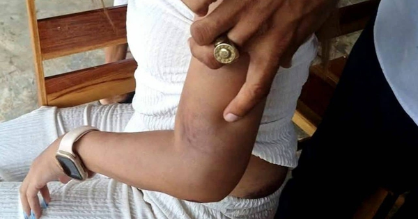 Bạn trai qua lại với 6 phụ nữ khác, cô gái hỏi đến liền bị đối phương tấn công, phải nhảy khỏi ban công avatar1748495173129 1748495173784774194742jpg