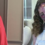 Cô gái bị chó dữ cắn 800 nhát trên mặt có diện mạo mới sau 4 năm phẫu thuật avatar1749274931796 17492749322501529422723 0 73 273 510 crop 17492749423111518417552png