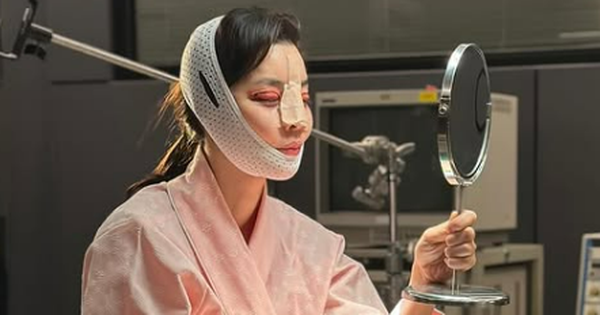 Mỹ nhân Giày Thủy Tinh gây sốc với gương mặt sưng tấy đáng sợ, băng bó kín mít avatar1750035204248 17500352046261952891156 0 0 232 443 crop 1750035217701456817469png