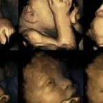 Nghiên cứu Mỹ: Chồng hút thuốc, vợ sảy thai, đứa trẻ chưa ra đời đã phải học cách chịu đựng khói thuốc avatar1750391668933 17503916698631860357637jpg