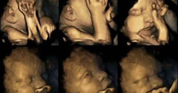 Nghiên cứu Mỹ: Chồng hút thuốc, vợ sảy thai, đứa trẻ chưa ra đời đã phải học cách chịu đựng khói thuốc avatar1750391668933 17503916698631860357637jpg