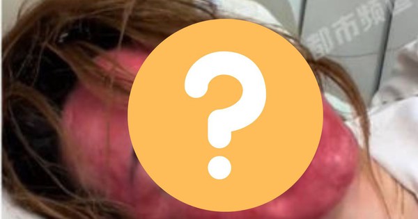 Khuôn mặt của người phụ nữ 22 năm không tẩy trang gây sốc avatar1750393151662 17503931521331470154937 0 0 788 1260 crop 1750393199393214433138jpg