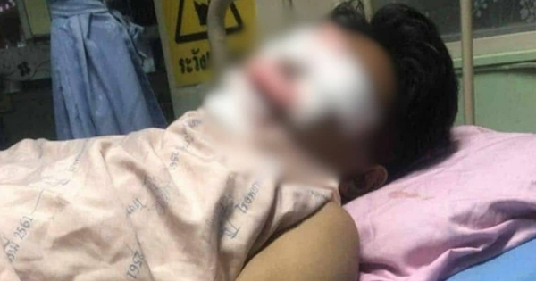 Thiết bị điện phát nổ khiến 3 người bị thương, cảnh sát điều tra phát hiện những dấu hiệu đáng ngờ avatar1750918770727 17509187713761456936574 0 100 720 1252 crop 17509187875001826822272jpg