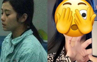 30 tỷ, 8 năm phẫu thuật, làm đám cưới với bác sĩ thẩm mỹ, số phận hot girl xinh đẹp nay ra sao? avatar1751617781931 1751617782172519407837jpg