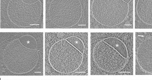 Phát hiện cấu trúc mới bí ẩn trong tế bào người avatar1752639539973 17526395406381843033028 0 9 315 513 crop 1752639559708859112455jpg