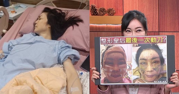 "Nữ hoàng dao kéo" chuyển từ giường bệnh ung thư sang… giường phẫu thuật thẩm mỹ, gây mê suốt 6 tiếng để căng da! avatar1753966909995 1753966910903280520172 0 0 352 672 crop 17539670040421747740008jpg