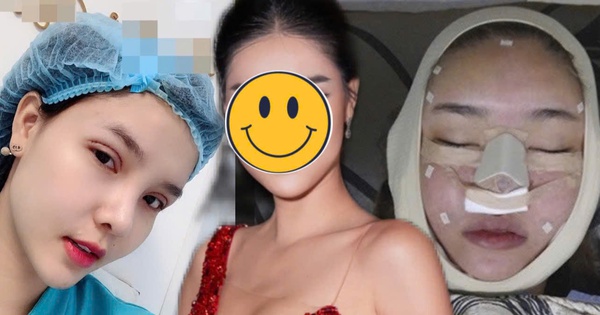 Người mẫu Việt tự khui ảnh thẩm mỹ mặt, thừa nhận rơi khủng hoảng vì sợ biến dạng vĩnh viễn avatar1754530001257 17545300017881955625100jpg