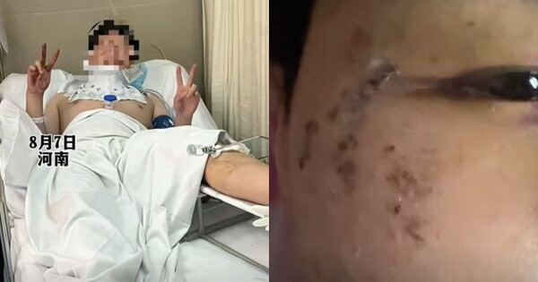 Nằm mơ mình bị rượt đuổi, thanh niên lao từ cửa sổ tầng 3 xuống đất mà không hề hay biết avatar1754822504414 17548225054281595827570 0 0 375 600 crop 17548225129581522063033jpg