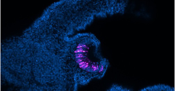 Loài vật có thể "mọc lại" cả nhãn cầu: Phát hiện mới mở kỳ vọng cho y học tái tạo của con người avatar1754907315887 1754907316271780841386 27 0 483 730 crop 17549073248171532505688jpg