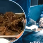 Cao 1m6 nhưng chỉ nặng 35kg, bé gái 15 tuổi nhập viện, bác sĩ bàng hoàng phát hiện thứ trong bụng bệnh nhi avatar1755514349434 17555143498282024030516png