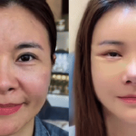 Diễn viên Kim Oanh lên tiếng sau khi gây tranh cãi vì phẫu thuật thẩm mỹ cả gương mặt avatar1755823073698 175582307423677162812png