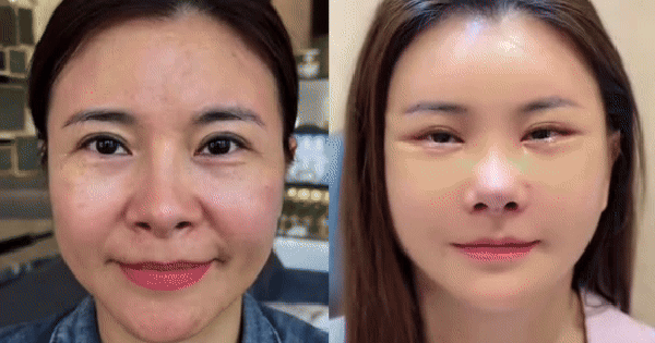 Diễn viên Kim Oanh lên tiếng sau khi gây tranh cãi vì phẫu thuật thẩm mỹ cả gương mặt avatar1755823073698 175582307423677162812png