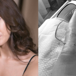 Siêu mẫu Minh Tú sốc vì bị đứt dây chằng chéo trước, rách sụn, dập xương avatar1756516097548 1756516098018925770956png