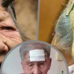 Cụ bà 98 tuổi dùng kéo cắt 'sừng trường thọ' trên trán, dẫn đến nguy kịch avatar1756890035693 17568900360701651759506 0 67 271 501 crop 1756902479935988004916jpeg